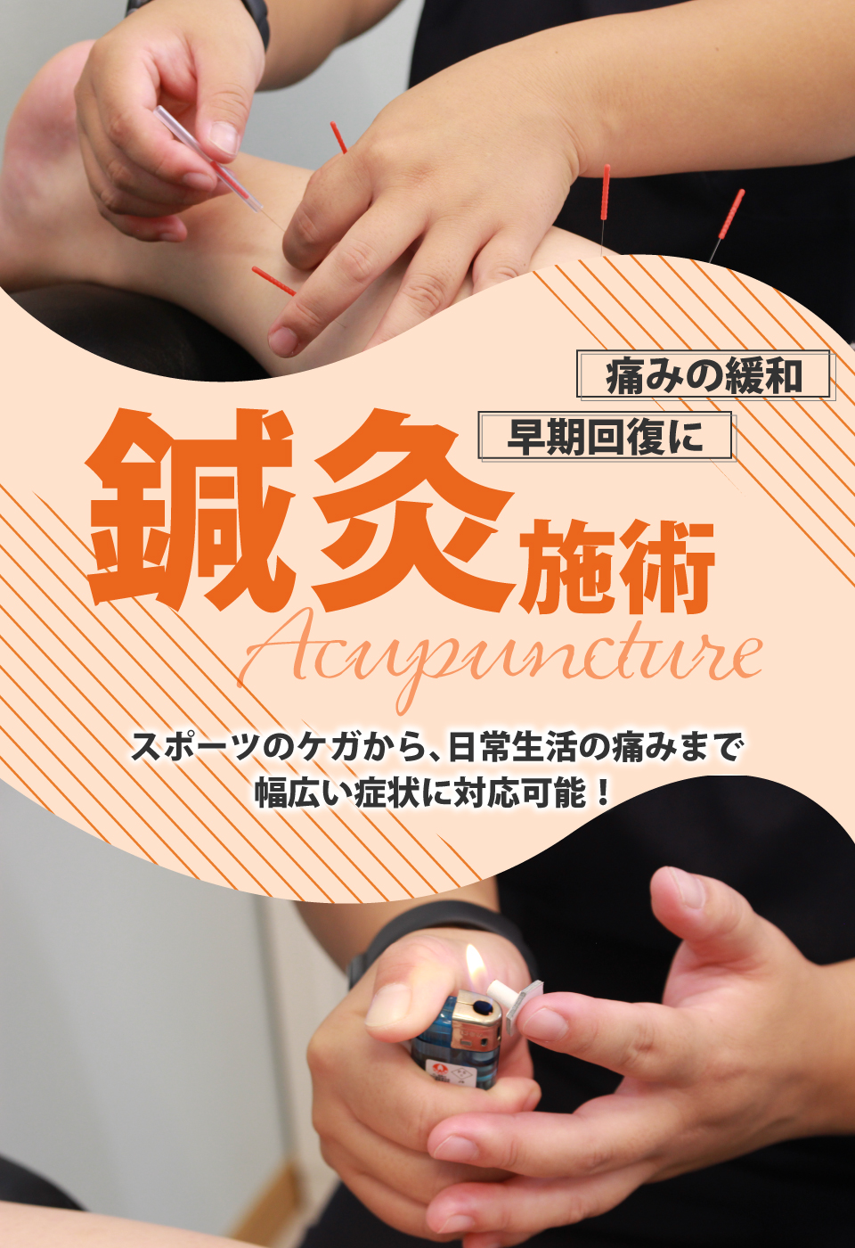 【春日部市】ひなた接骨院・鍼灸院｜鍼灸施術